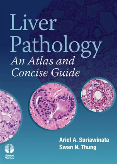 Liver pathology [electronic resource] : an atlas and concise guide / Arief A. Suriawinata, Swan N. Thung.