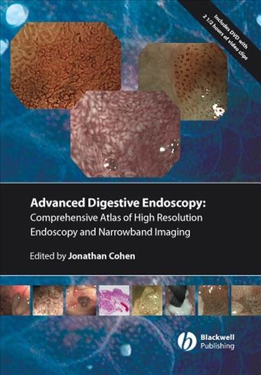 Comprehensive atlas of high resolution endoscopy and narrow band imaging [electronic resource] / edited by Jonathan Cohen.