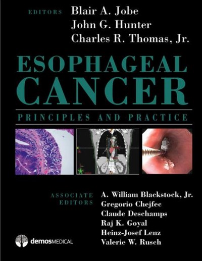 Esophageal cancer [electronic resource] : principles and practice / edited by Blair A. Jobe, Charles R. Thomas, Jr., John G. Hunter.