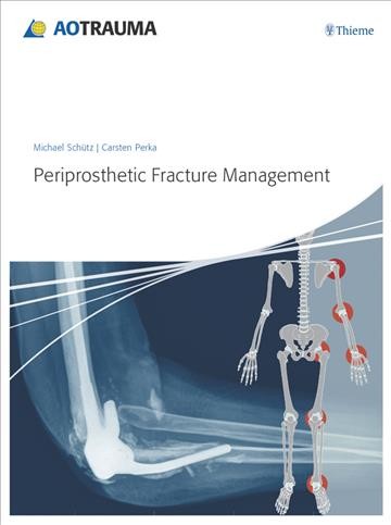 Periprosthetic fracture management / editors, Michael Schütz, Carsten Perka ; senior editor, Thomas Rüedi.